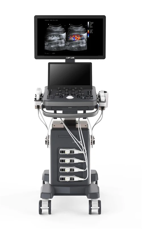 Uwchsain Delweddu Doppler Lliw Compact