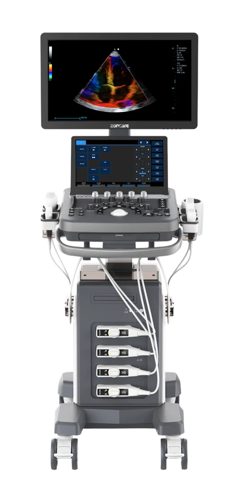 Uwchsain Doppler Lliw Compact
